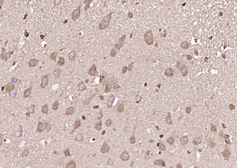 14 - DOCK7 Rabbit pAb AP54639