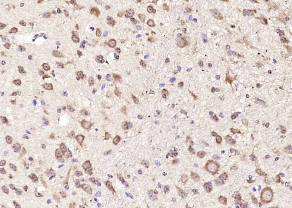 14 - GMF beta Rabbit pAb AP54647