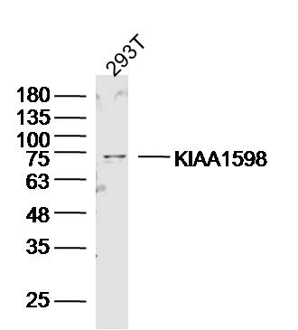1 - KIAA1598 Rabbit pAb AP54652