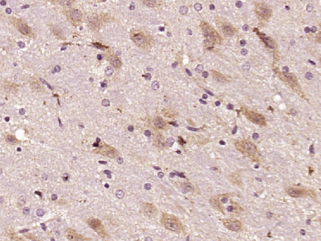 14 - KIAA1598 Rabbit pAb AP54652