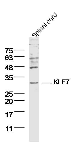 1 - KLF7 Rabbit pAb AP54654