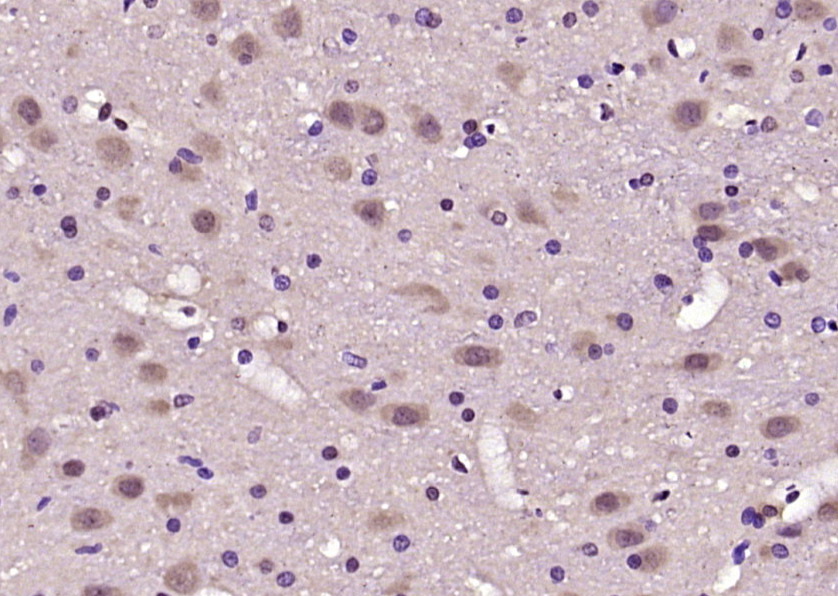 14 - MEIS2 Rabbit pAb AP54658