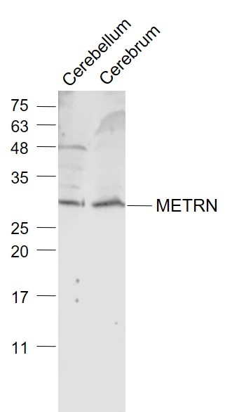 1 - METRN Rabbit pAb AP54659