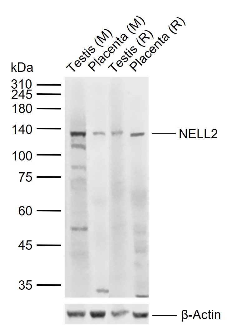 1 - NELL2 Rabbit pAb AP54664