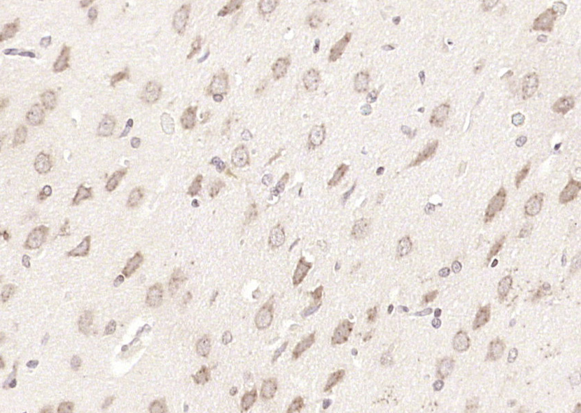 14 - NELL2 Rabbit pAb AP54664