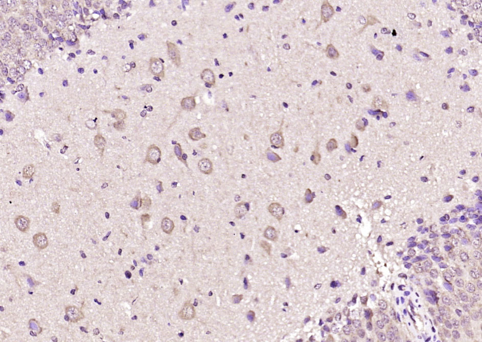 14 - ABCB9 Rabbit pAb AP54668