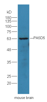 1 - PASD5 Rabbit pAb AP54671