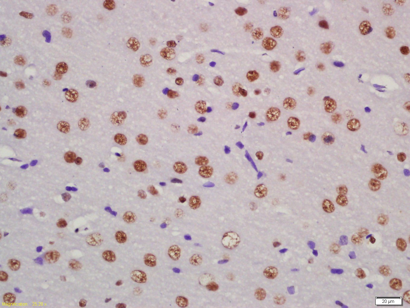 14 - PASD5 Rabbit pAb AP54671