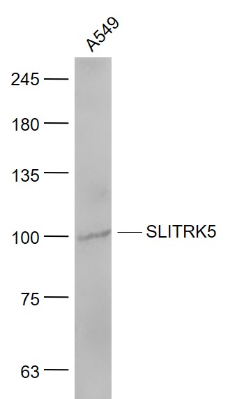 1 - SLITRK5 Rabbit pAb AP54686