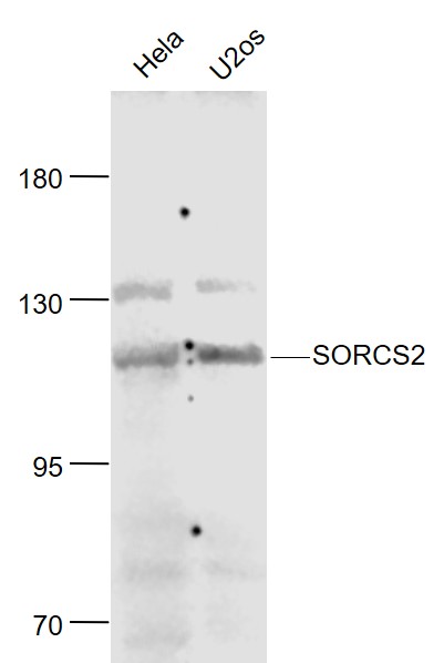 1 - SORCS2 Rabbit pAb AP54688