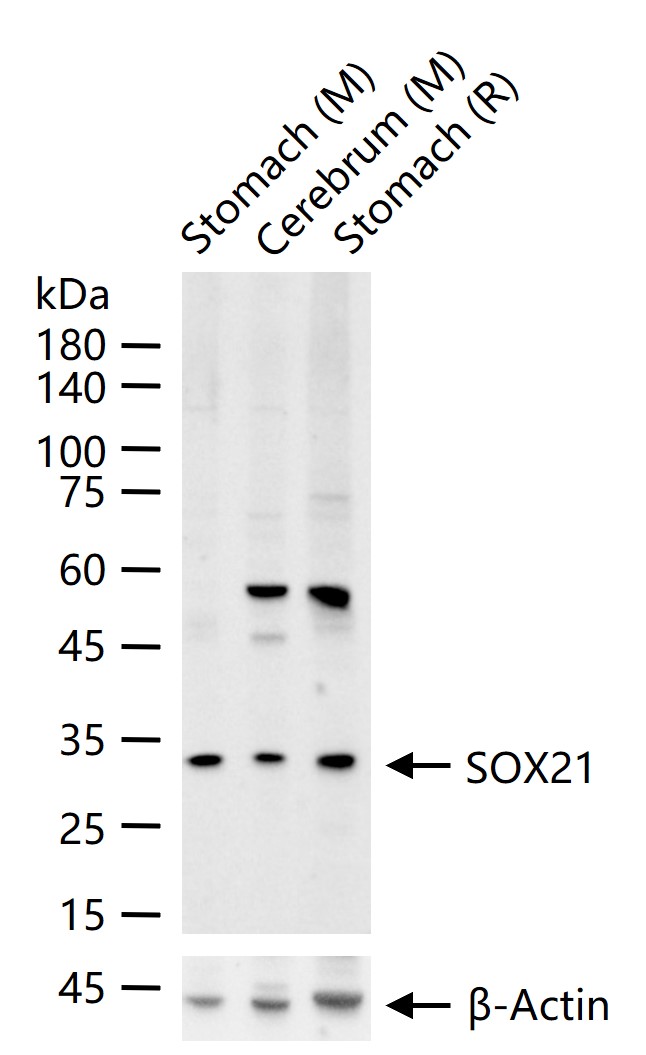 1 - SOX21 Rabbit pAb AP54689