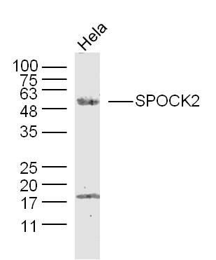 1 - SPOCK2 Rabbit pAb AP54690