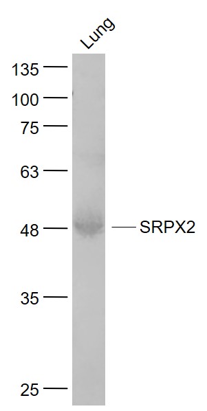 1 - SRPX2 Rabbit pAb AP54691