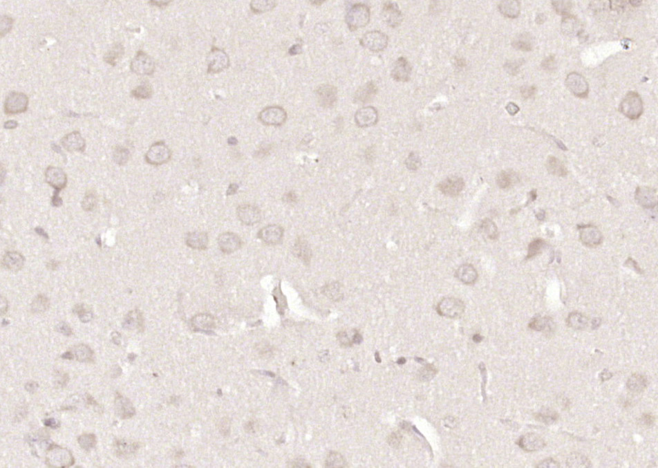 14 - Neurabin 1 Rabbit pAb AP54700