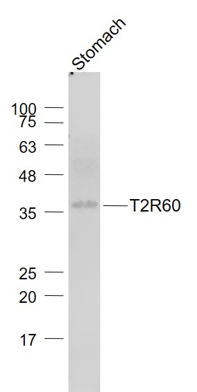 1 - T2R60 Rabbit pAb AP54713
