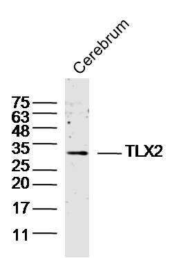 1 - TLX2 Rabbit pAb AP54716