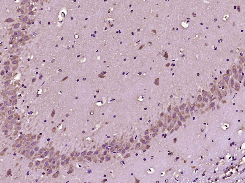 14 - SCN7A Rabbit pAb AP54735