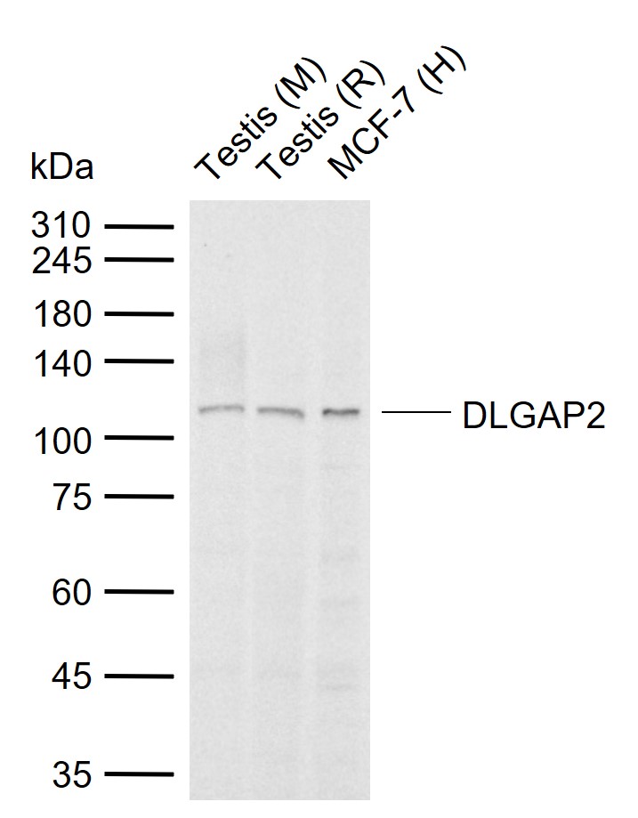 1 - DLGAP2 Rabbit pAb AP54743