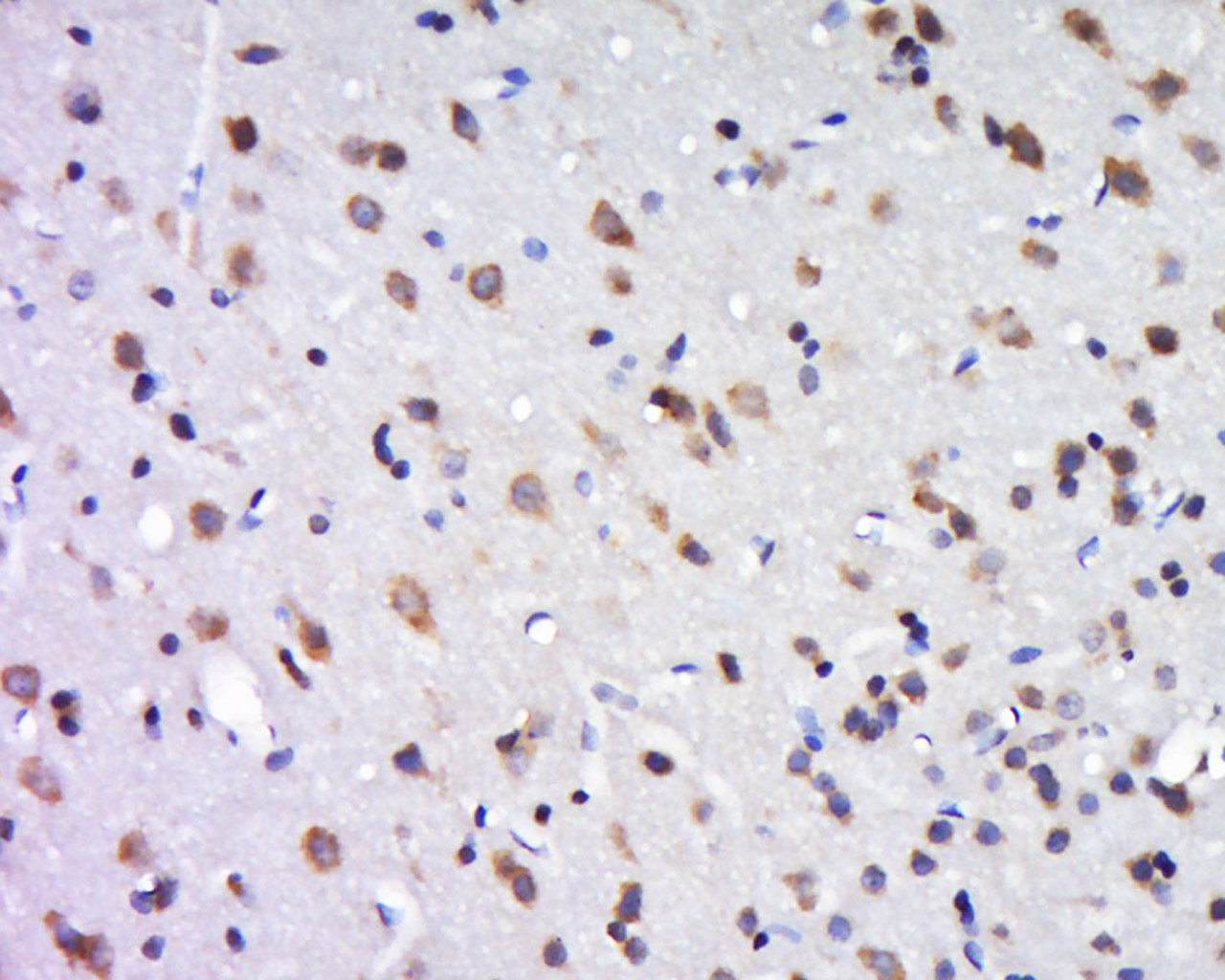 14 - DLGAP2 Rabbit pAb AP54743