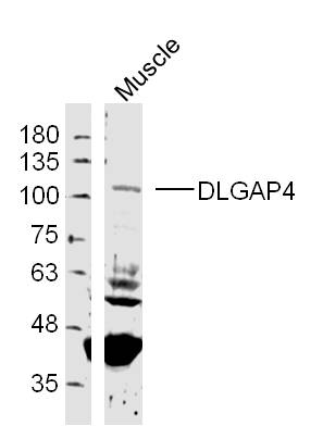 1 - DLGAP4 Rabbit pAb AP54744