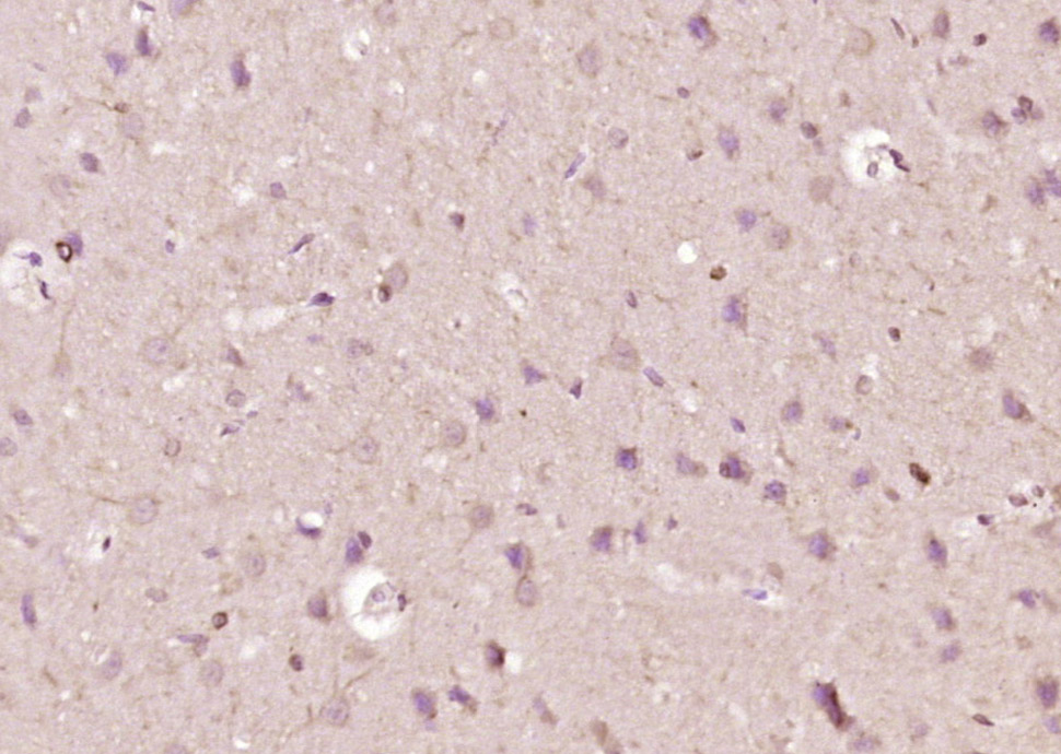 14 - PLPPR1 Rabbit pAb AP54749