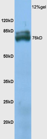1 - TXLNB Rabbit pAb AP54751