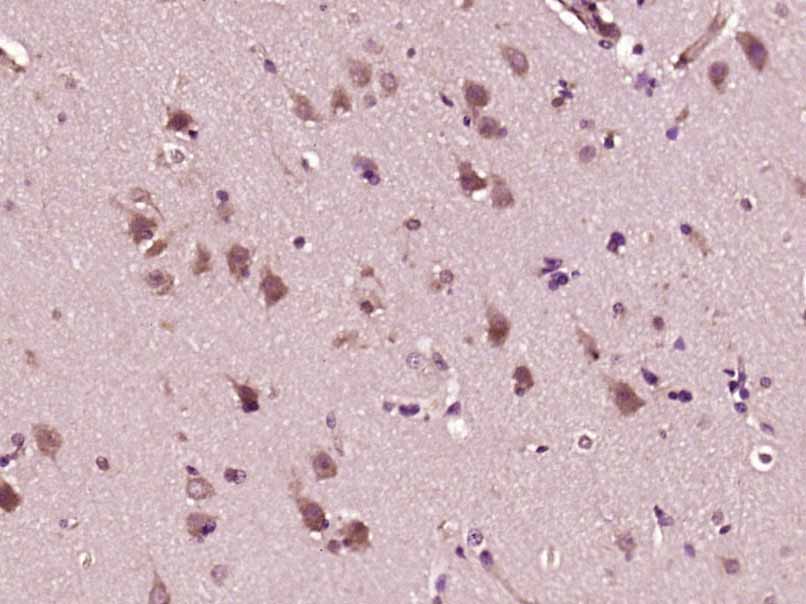 14 - Calcyphosine 1 Rabbit pAb AP54755