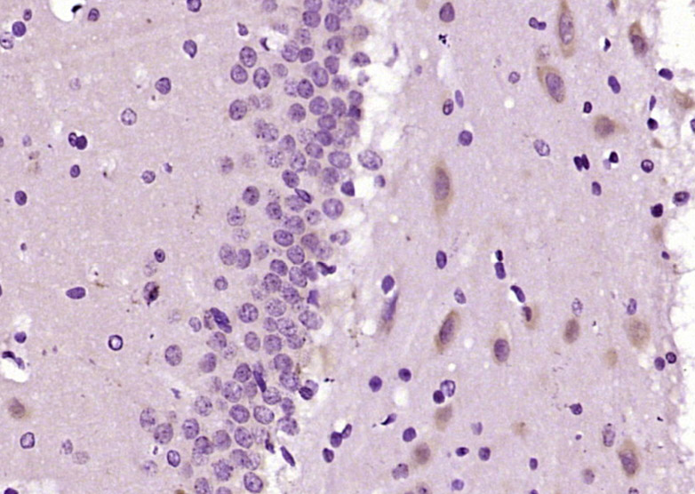 14 - FAM62C Rabbit pAb AP54757