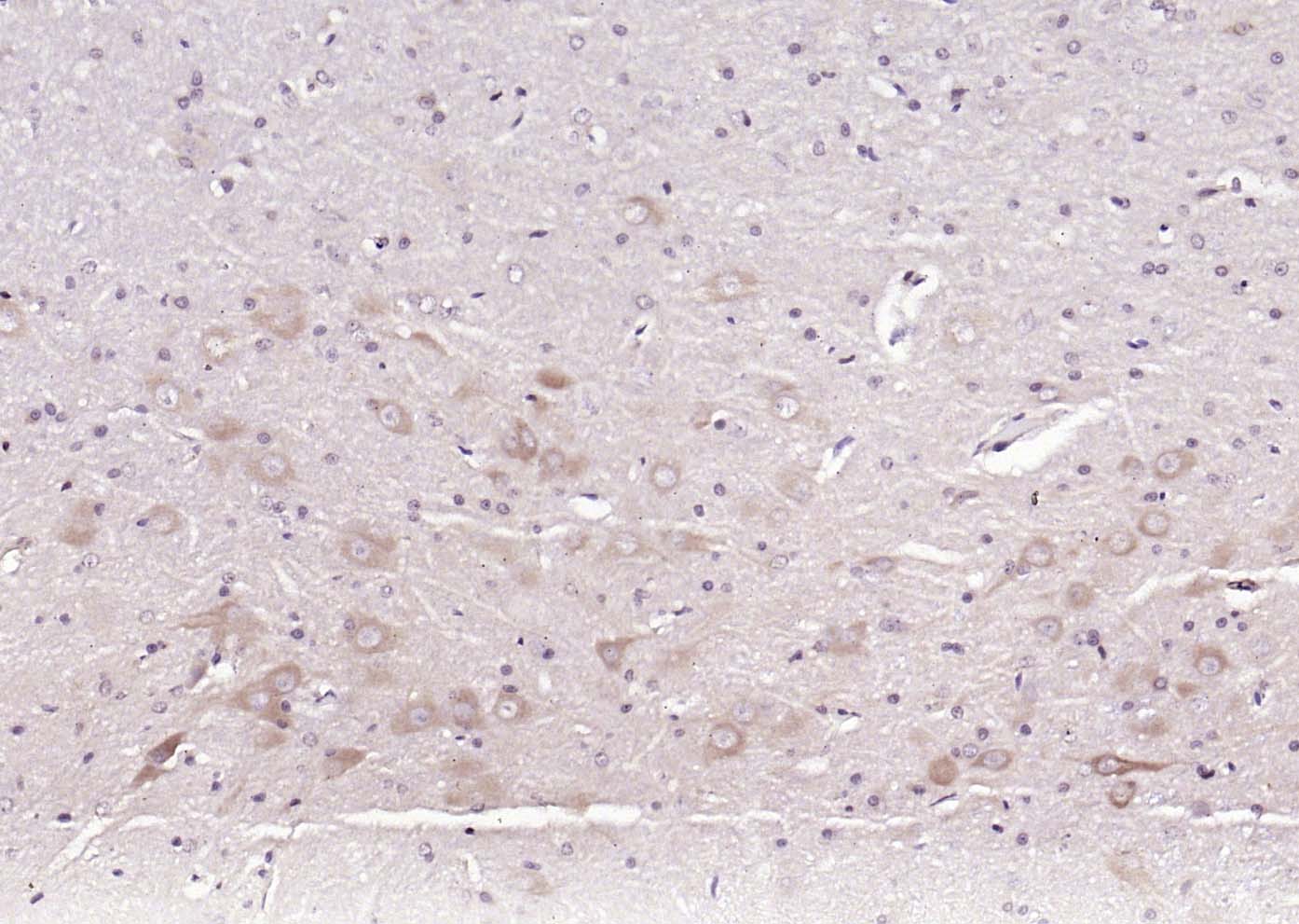 14 - Fibrillin 2 Rabbit pAb AP54758