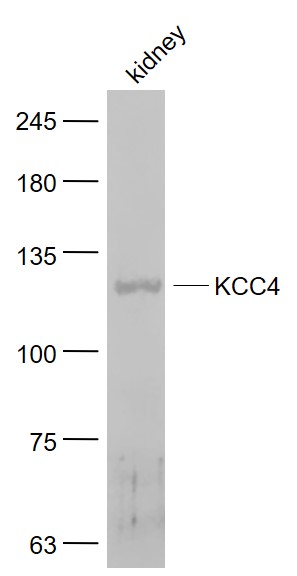 1 - KCC4 Rabbit pAb AP54760
