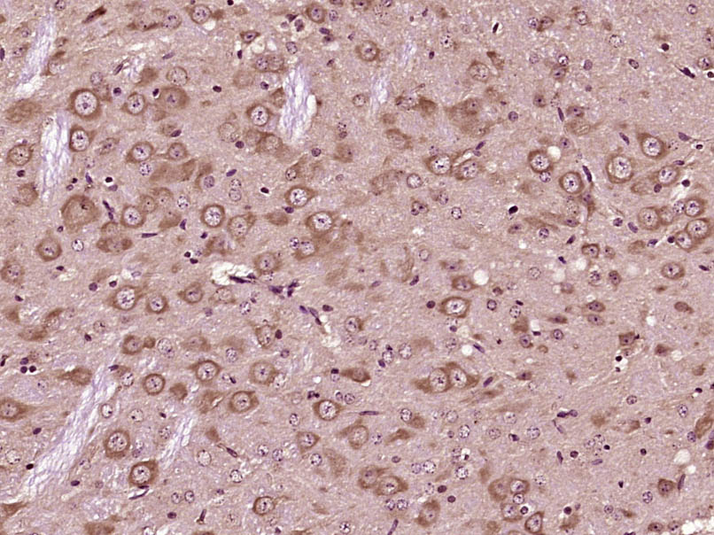 14 - KCNG1 Rabbit pAb AP54762