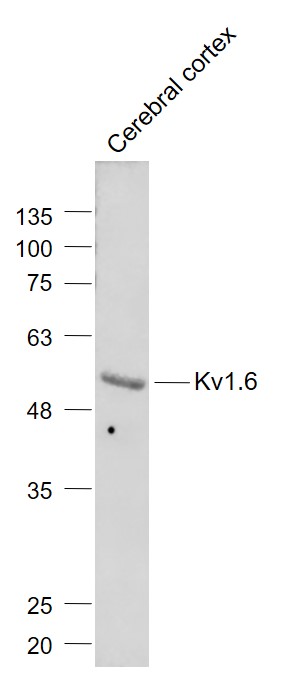 1 - Kv1.6 Rabbit pAb AP54765