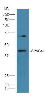 1 - SPAG4L/SRG4 Rabbit pAb AP54769