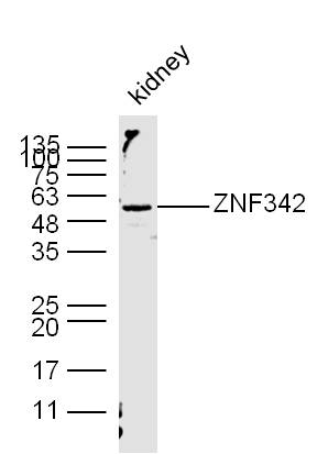 1 - ZNF342 Rabbit pAb AP54771