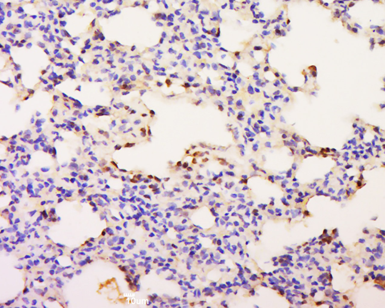 14 - ZNF342 Rabbit pAb AP54771
