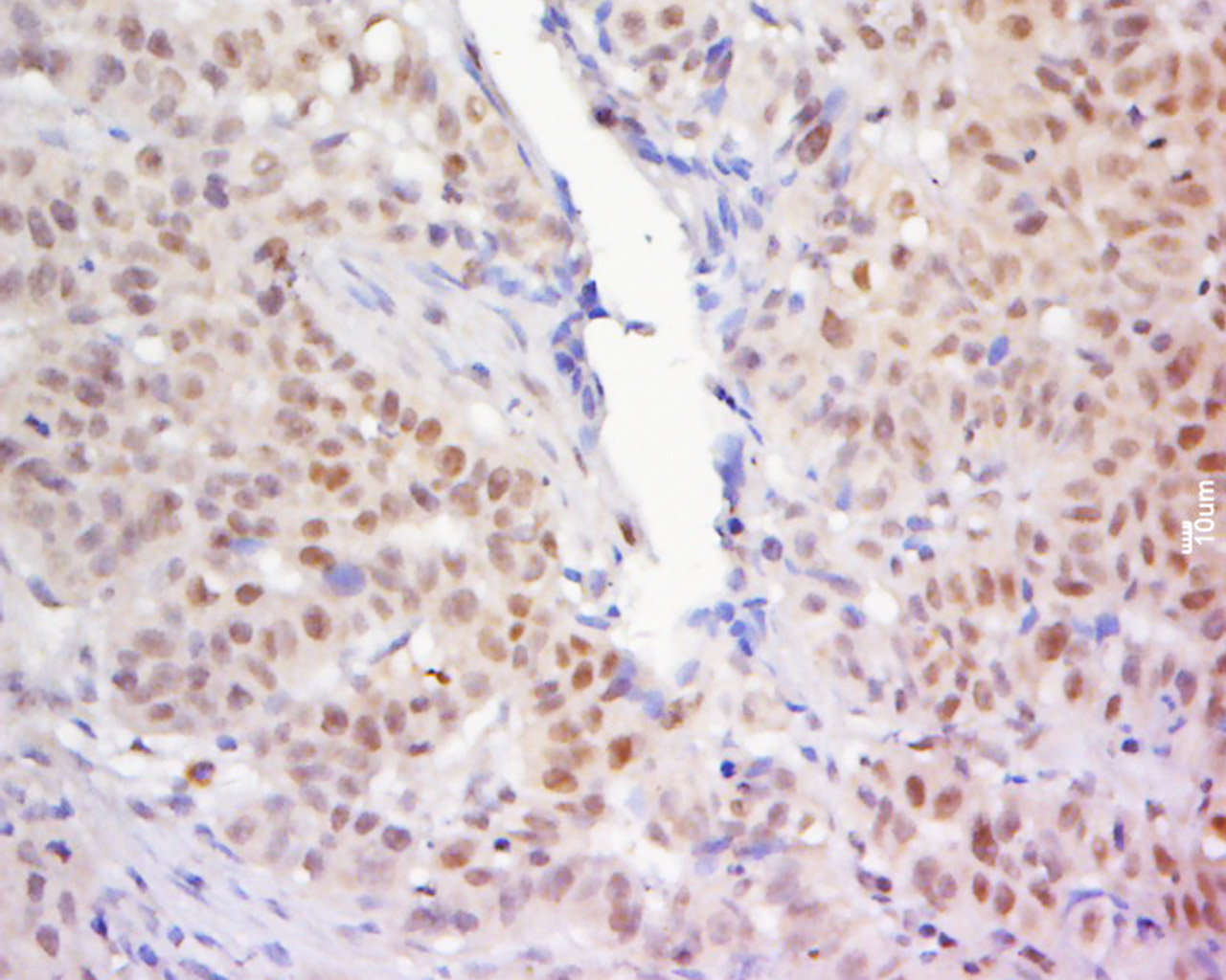14 - ZNF619 Rabbit pAb AP54783