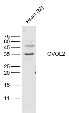 1 - OVOL2 Rabbit pAb AP54806
