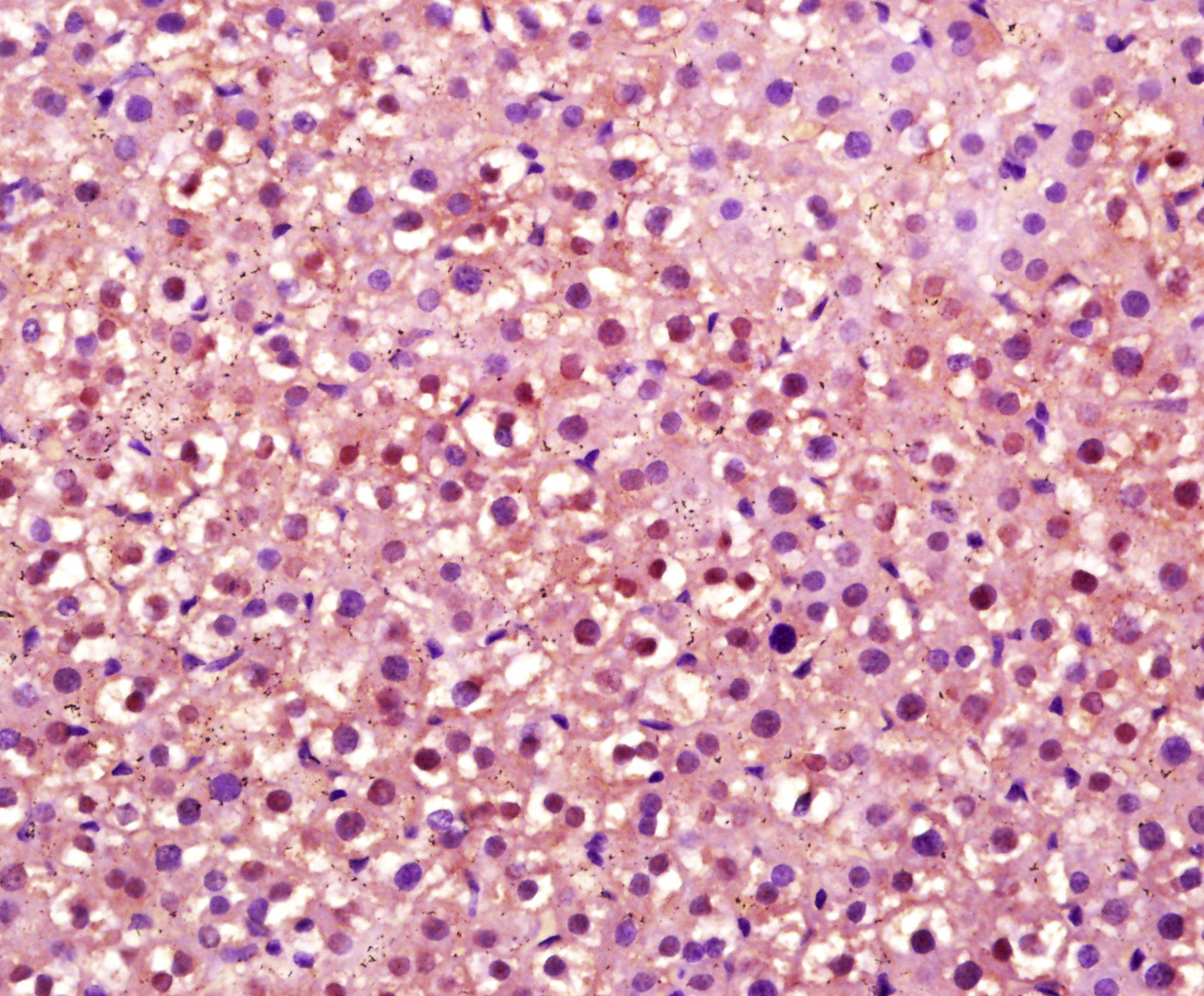 14 - OVOL2 Rabbit pAb AP54806