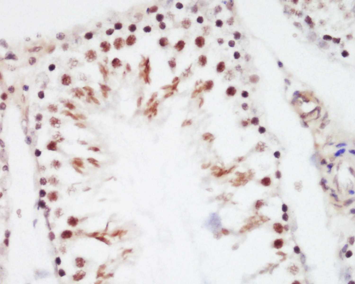 14 - RBMY1F Rabbit pAb AP54813