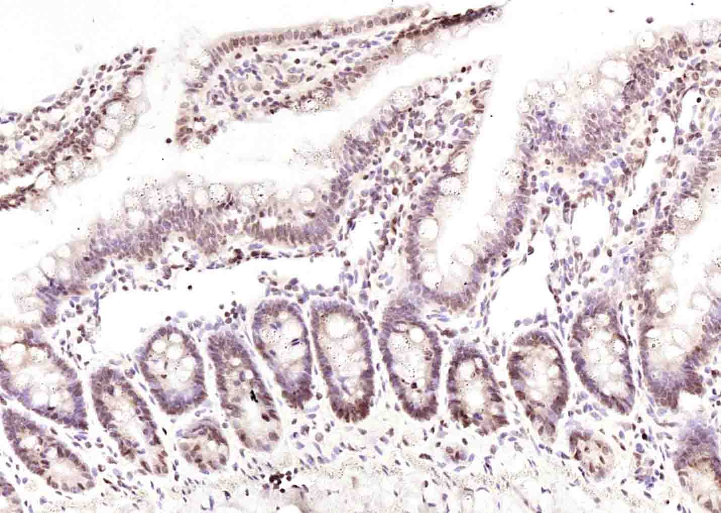 14 - TCTN1 Rabbit pAb AP54820