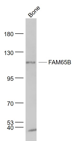 1 - FAM65B Rabbit pAb AP54840