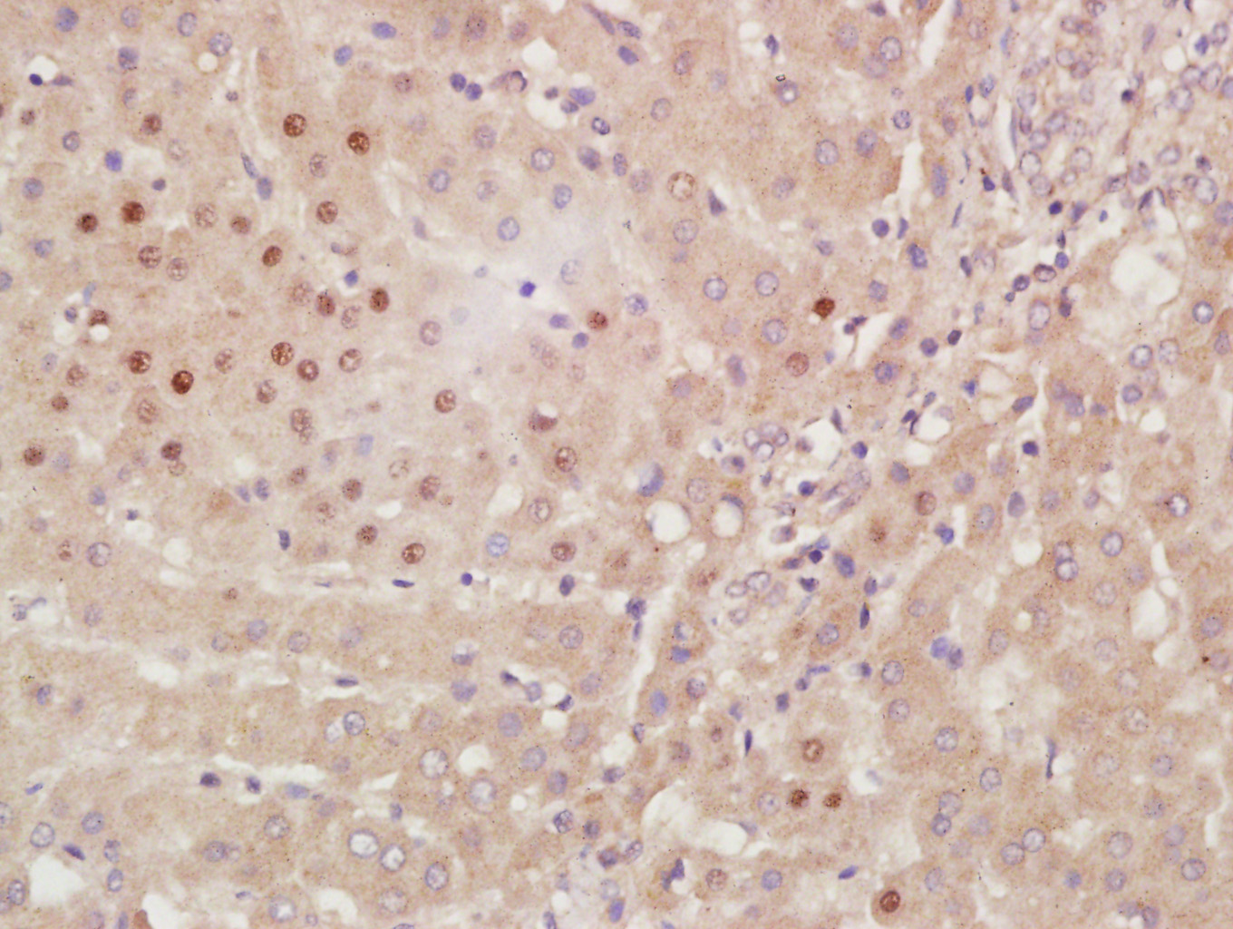 14 - HES3 Rabbit pAb AP54844