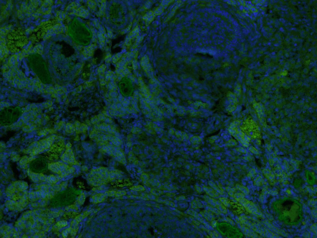 3 - KIF13B Rabbit pAb AP54845