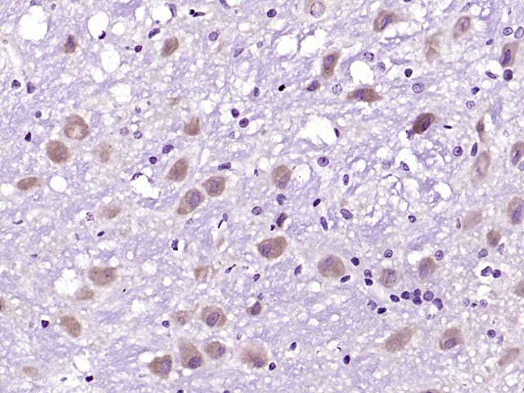 14 - CAPRIN2 Rabbit pAb AP54851