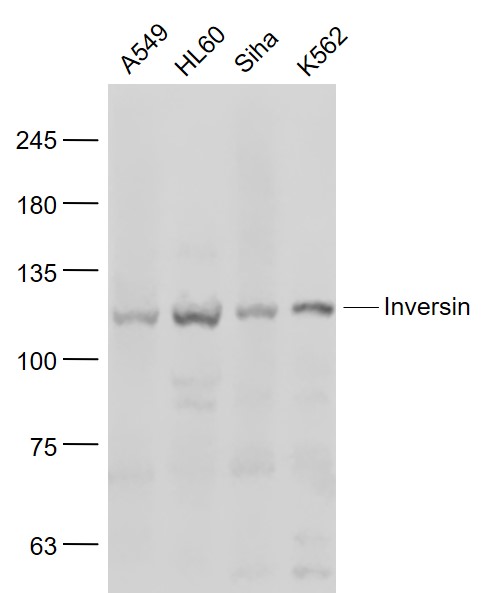 1 - Inversin Rabbit pAb AP54852