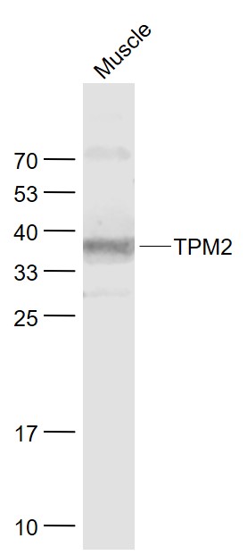 1 - TPM2 Rabbit pAb AP54853