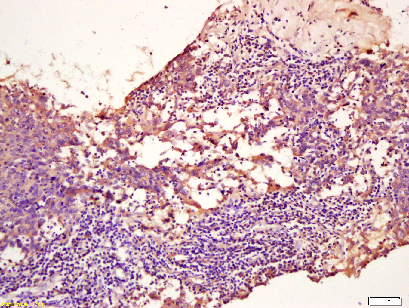 14 - TPM2 Rabbit pAb AP54853