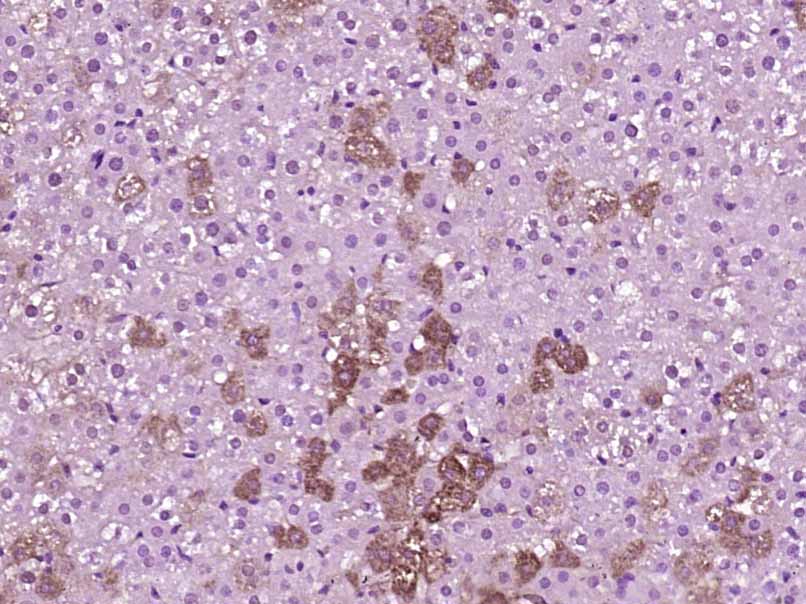 14 - PLEKHG5 Rabbit pAb AP54858