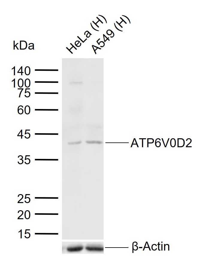1 - ATP6V0D2 Rabbit pAb AP54883