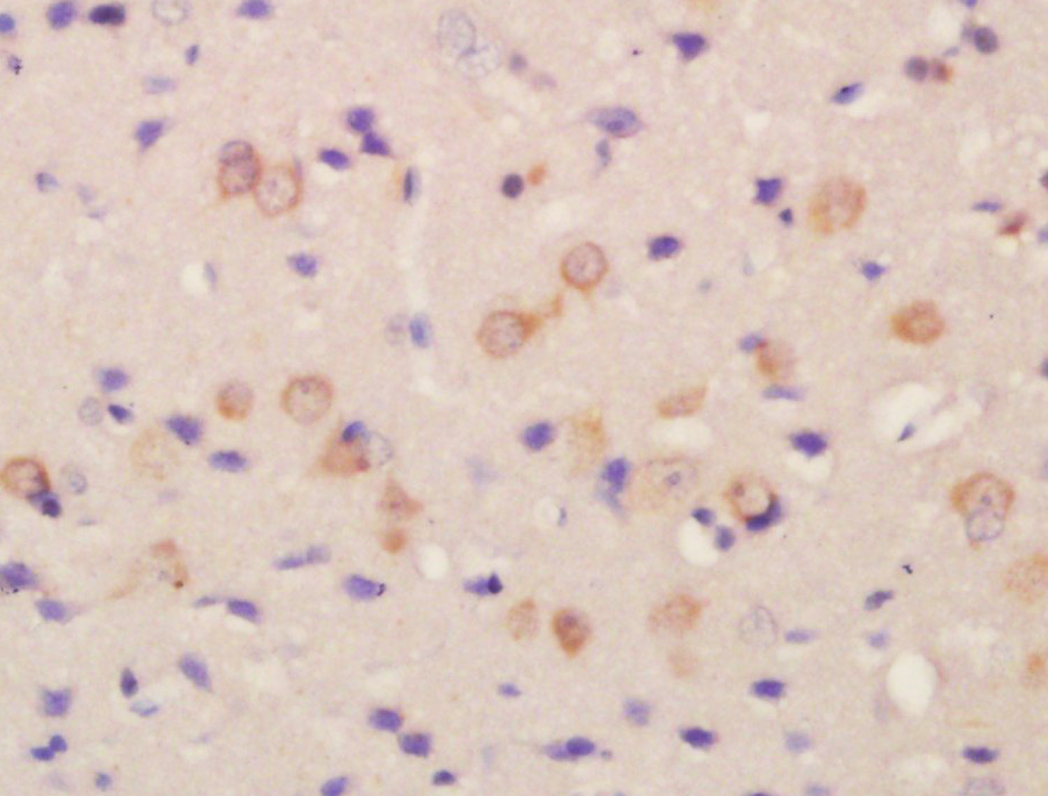 14 - FLRT2 Rabbit pAb AP54887